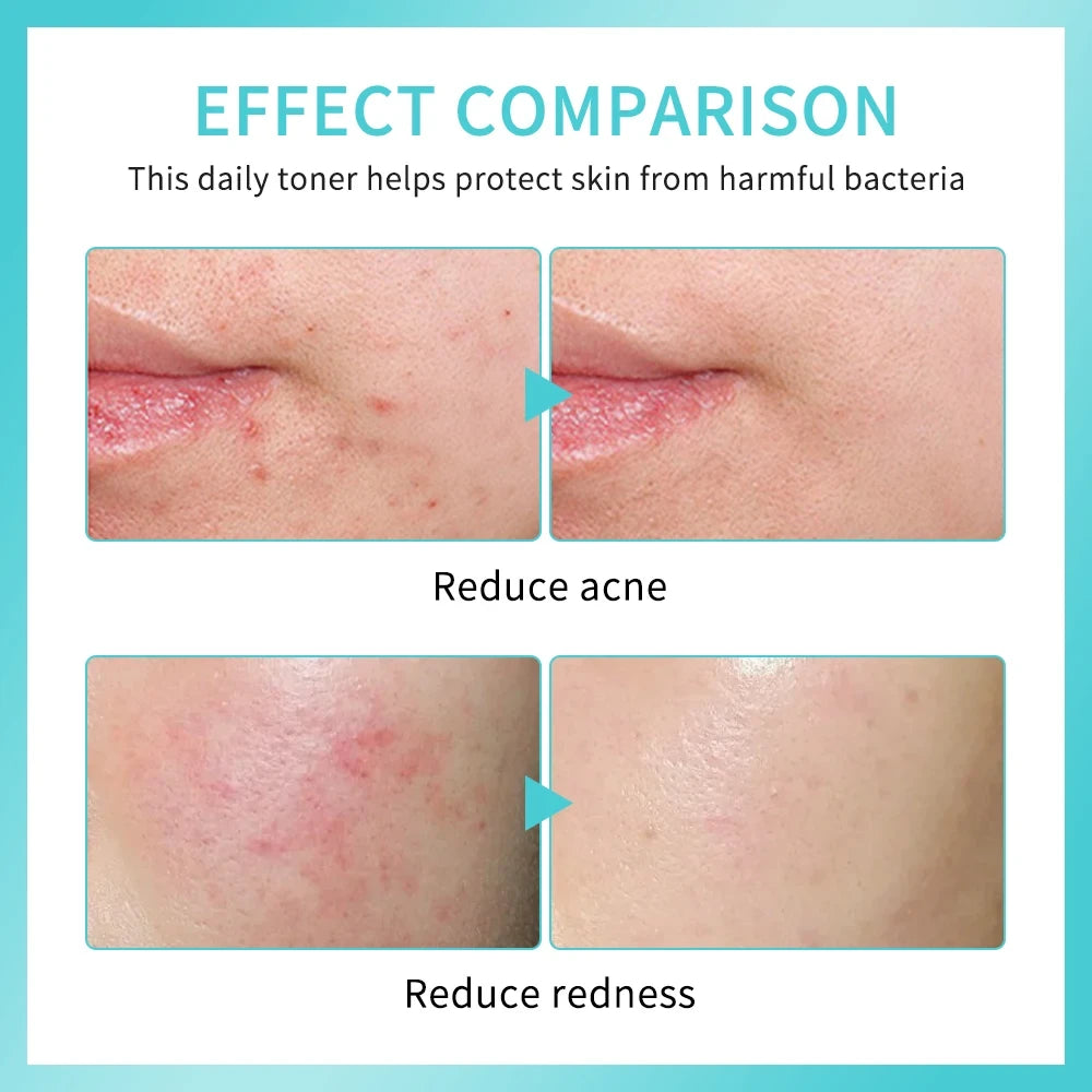 Hypochlorous Acid Face Toner