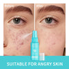 Hypochlorous Acid Face Toner