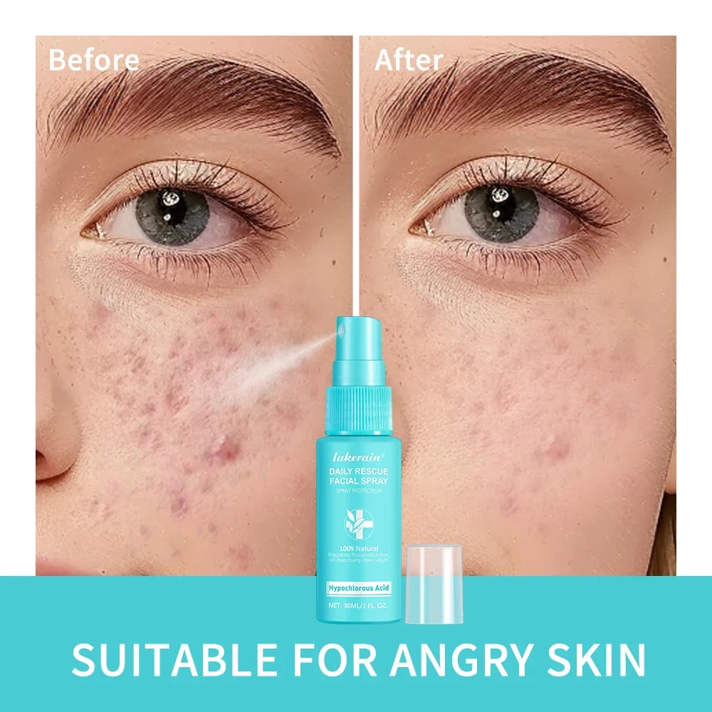 Hypochlorous Acid Face Toner